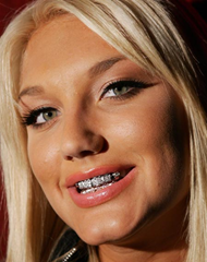 Girls Grillz