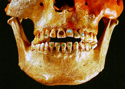 Grillz du Chiapas