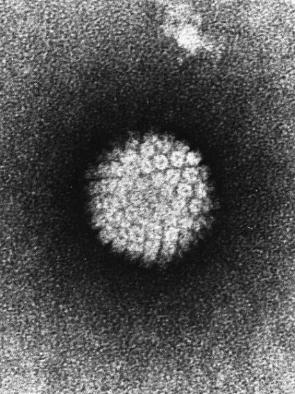 Papilloma Virus Humain en Microscopie Electronique  Transmission